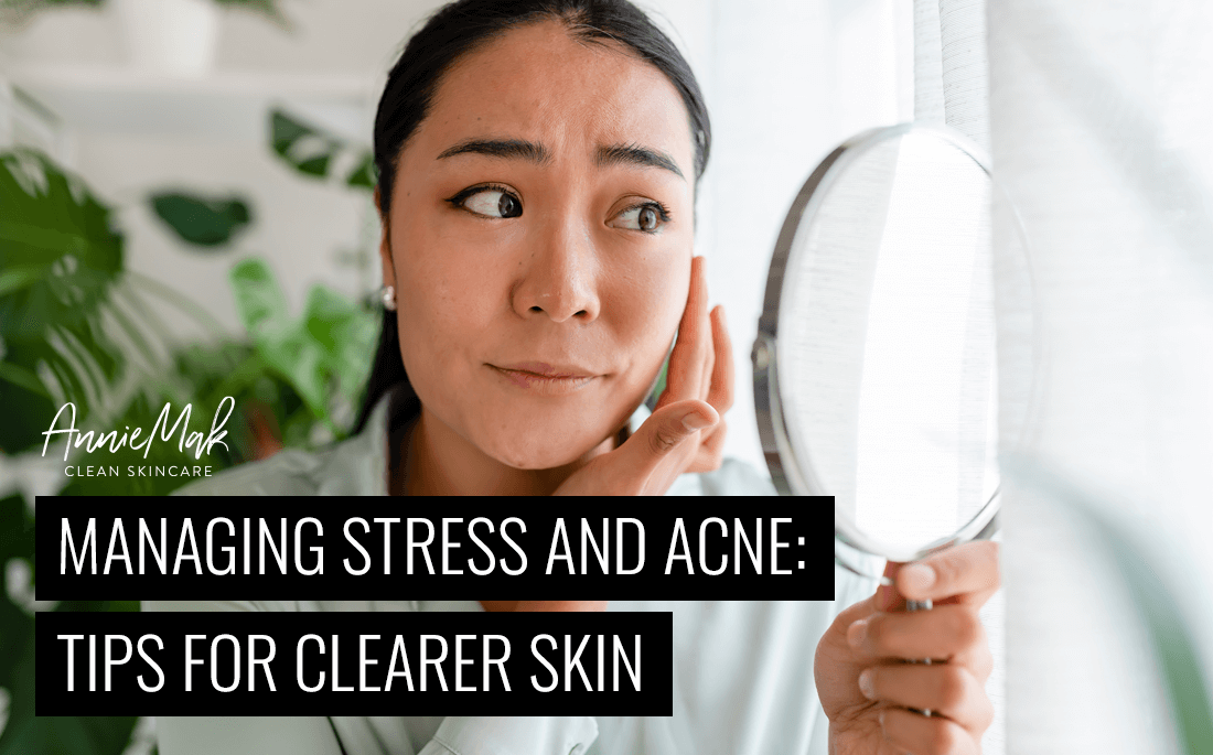 Let's face it, **stress and acne** often walk hand in hand, throwing a curveball at our confidence. But why does this happen? We're diving deep into the science behind stress-induced acne to shed light on how those tough days can end up showing on your skin.