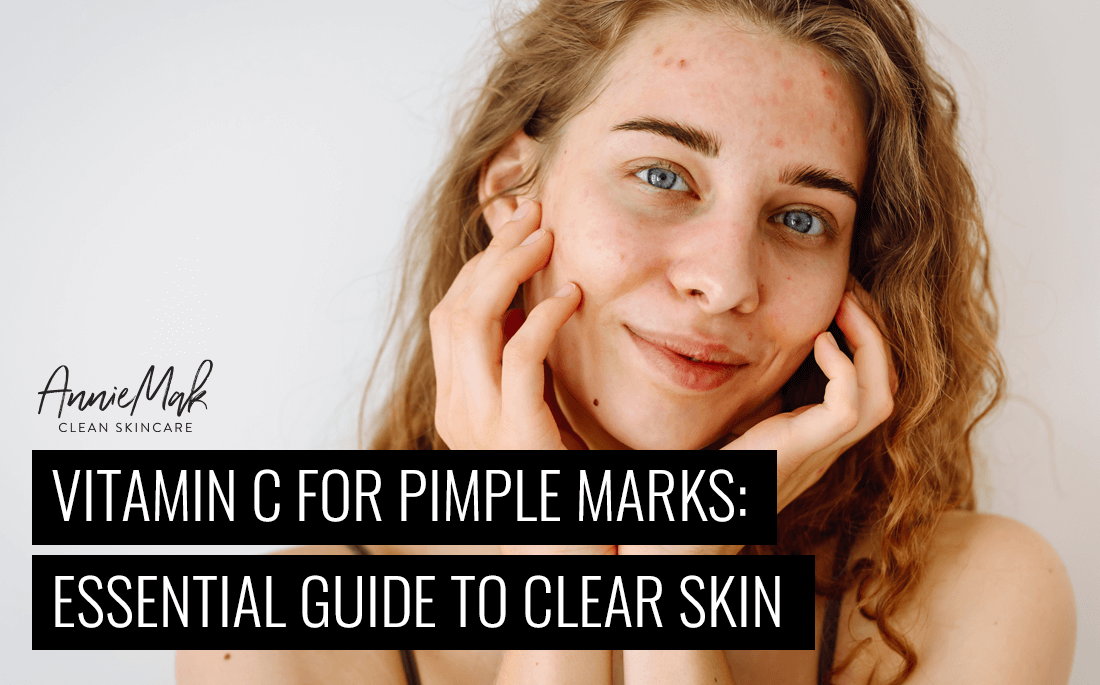 Vitamin C for Pimple Marks